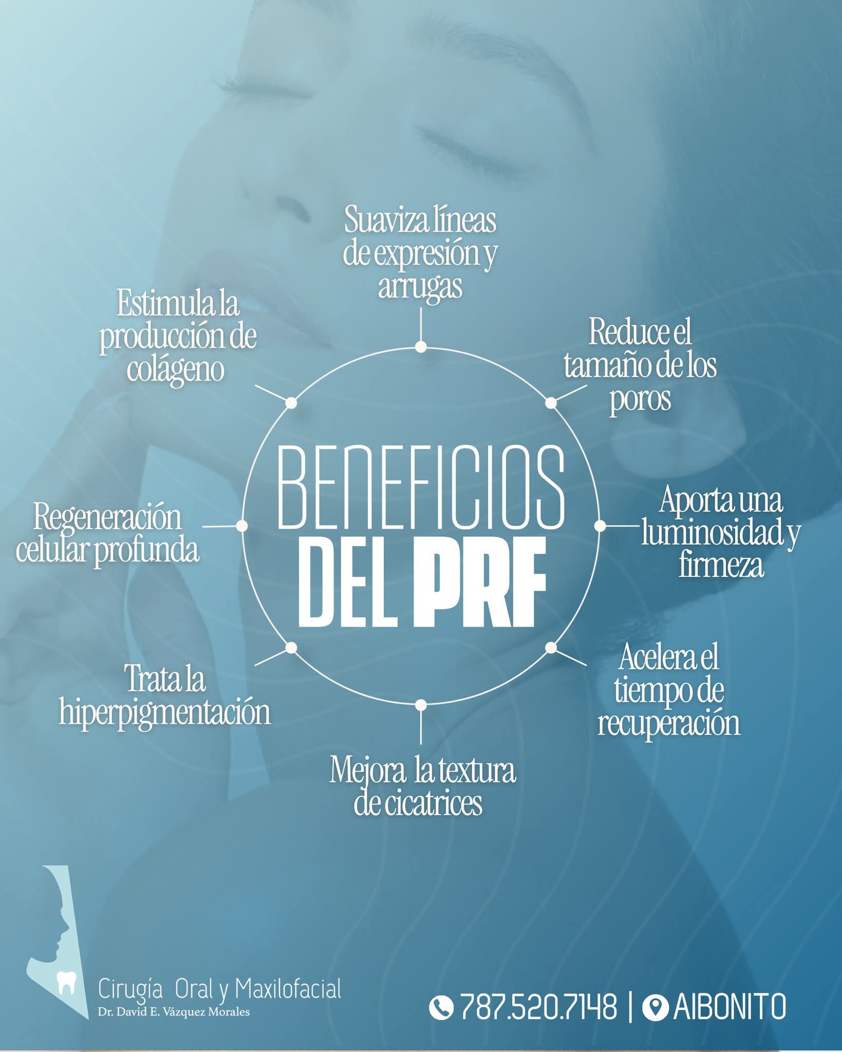 Microneedling with PRF (Platelet Rich Fibrin)