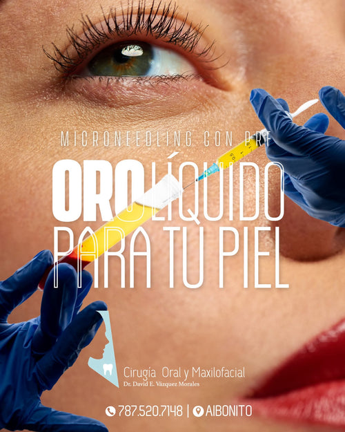 Microneedling with PRF (Platelet Rich Fibrin)